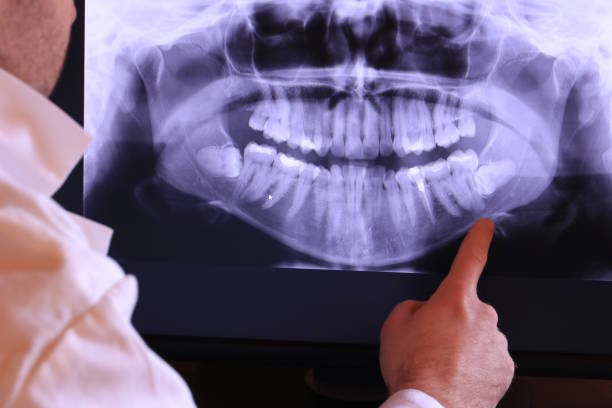 Best Weekend Emergency Dentist in Lindsay, CA